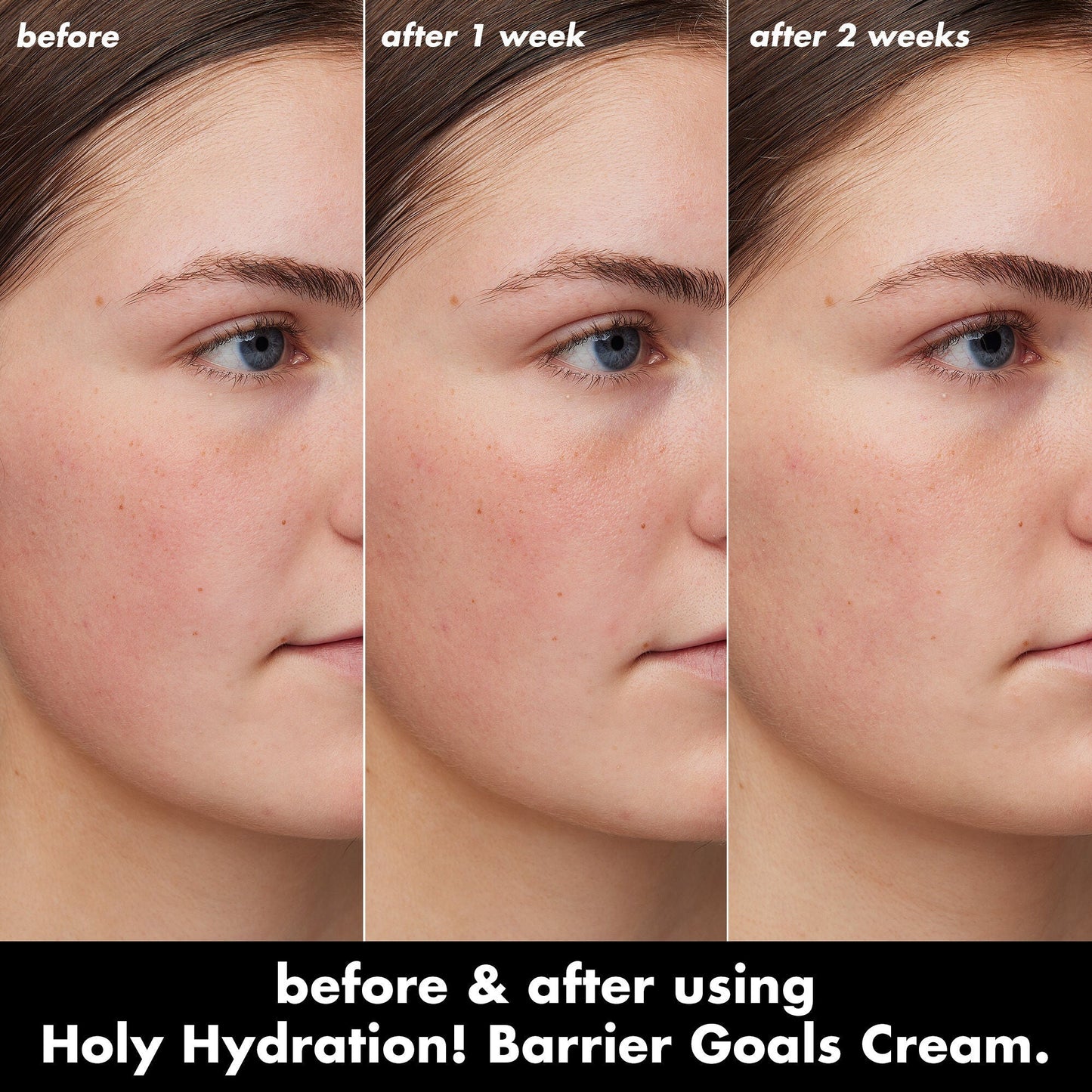 holy-hydration-barrier-goals-cream-mini-o7 0226_EDU_HHBarrierGoalsCream_B_A_Zoe_TRYPTICH_4f0e5b5d-35fb-4020-968e-244d4536afbd.jpg
