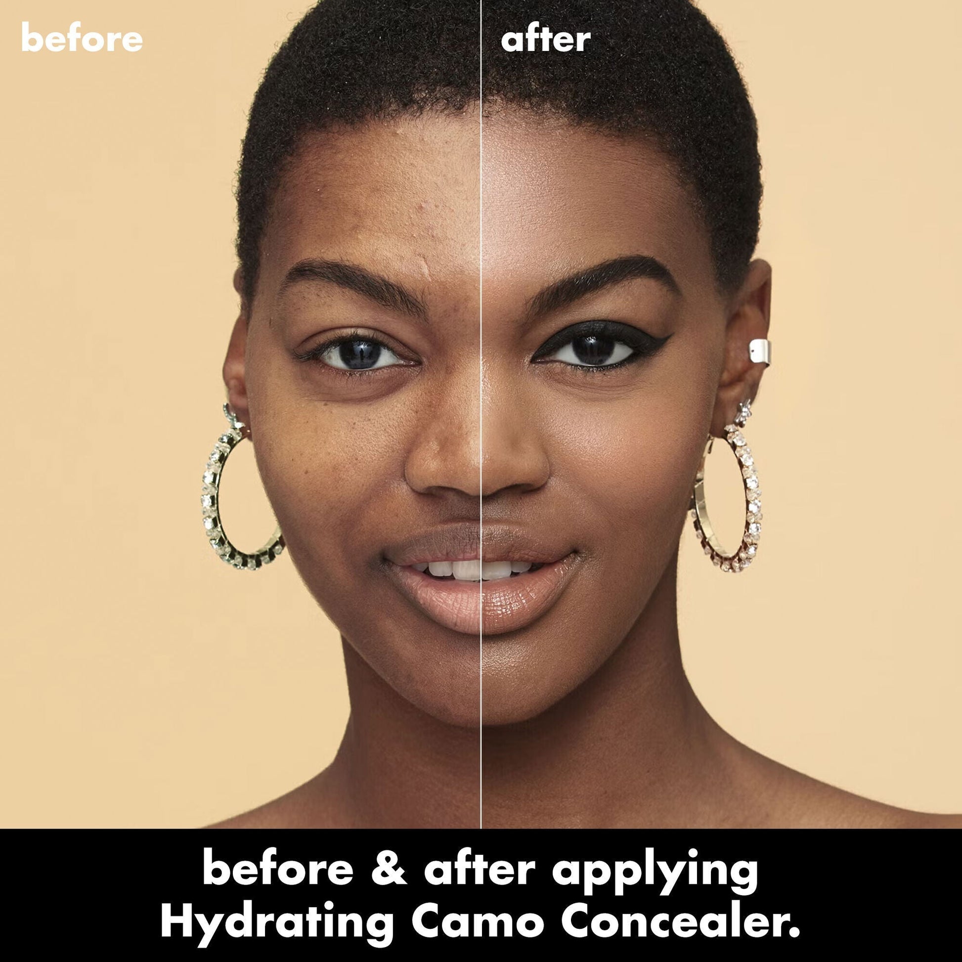 hydrating-camo-concealer-f9 0226_EDU_HydratingCamoConcelaer_BA_AshleyKaresh_20_1_d8499bbf-0e91-4173-b5e2-75127caf83a3.jpg