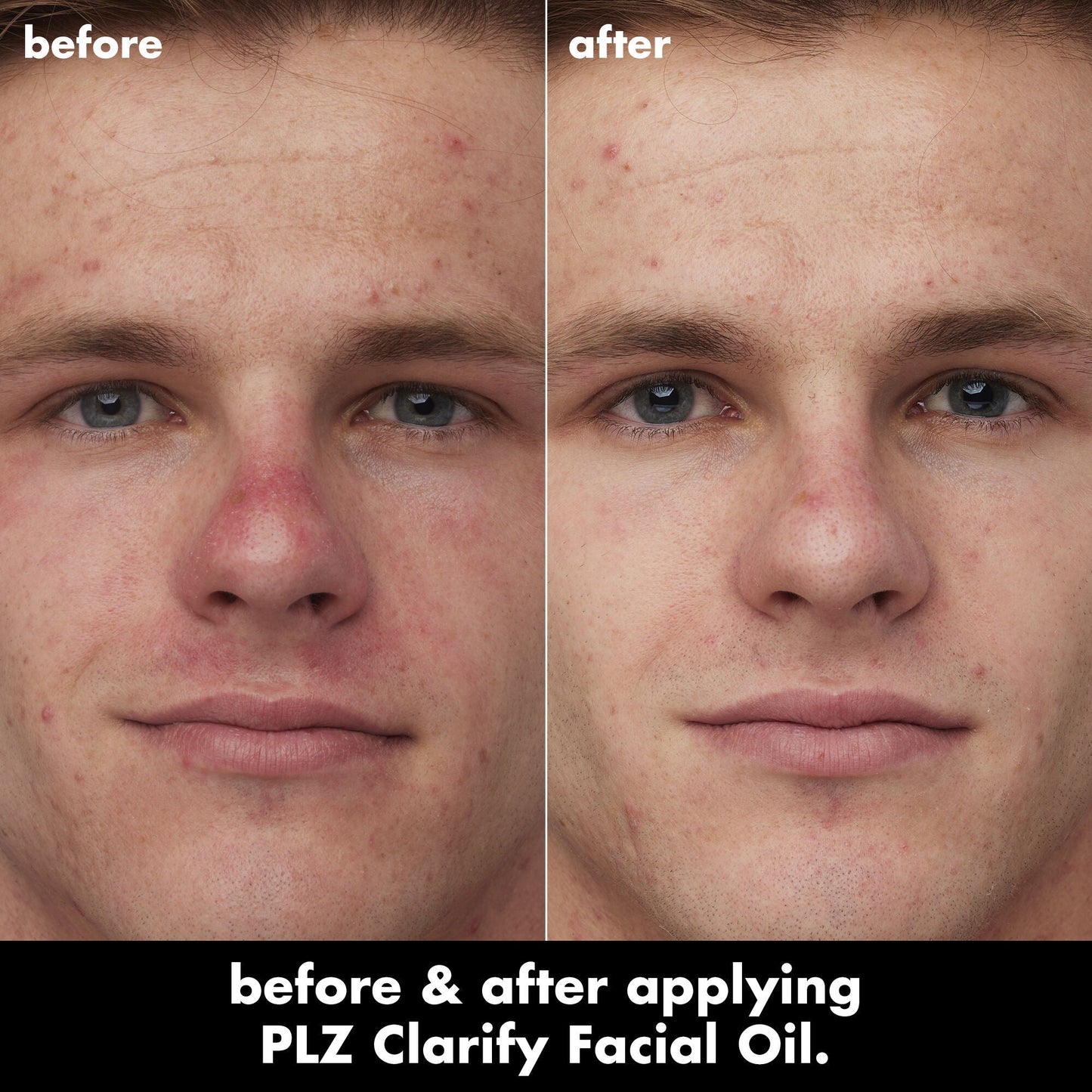 plz-clarify-facial-oil-d3 0326_EDU_PlzClarify_BA_Caleb.jpg