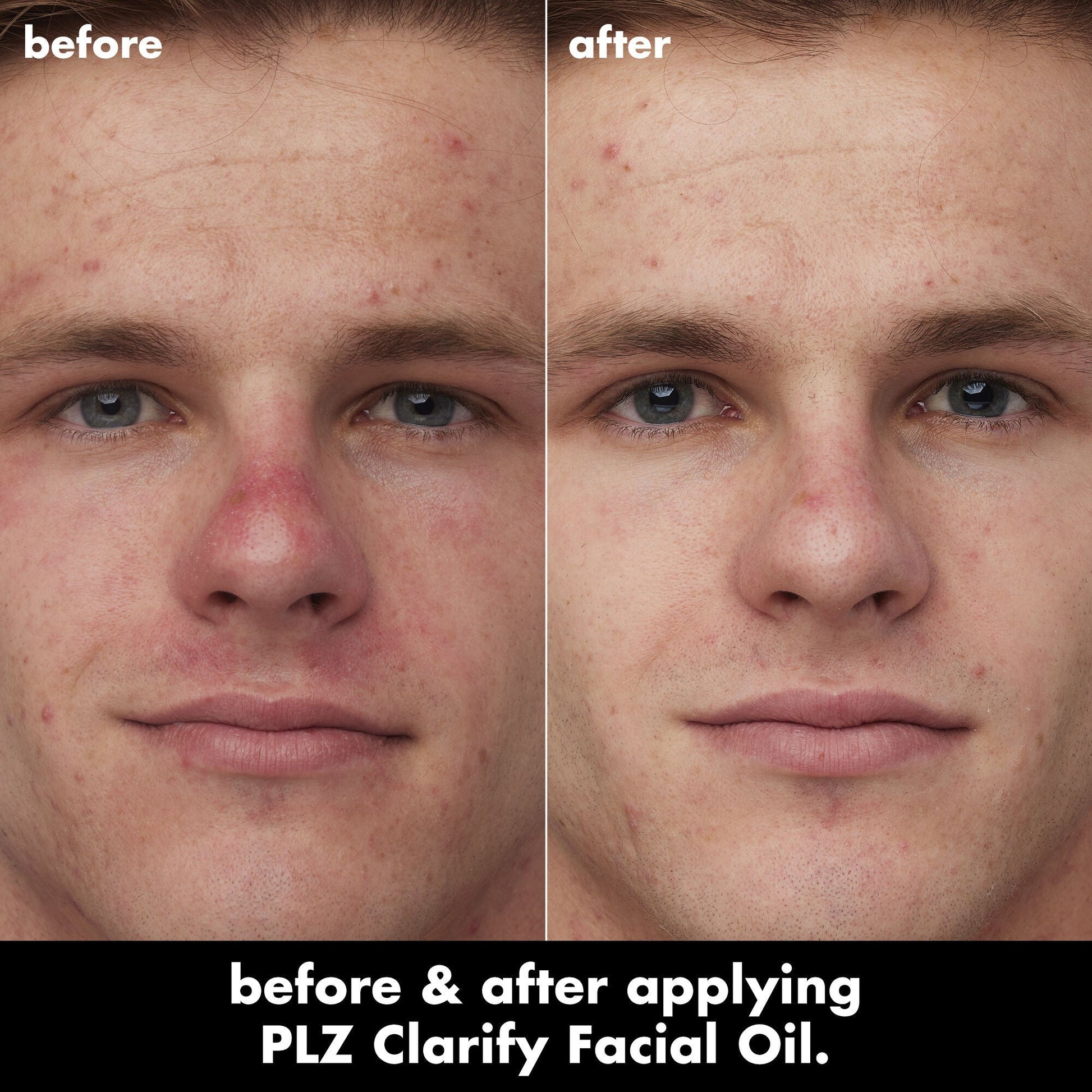 plz-clarify-facial-oil-d3 0326_EDU_PlzClarify_BA_Caleb.jpg