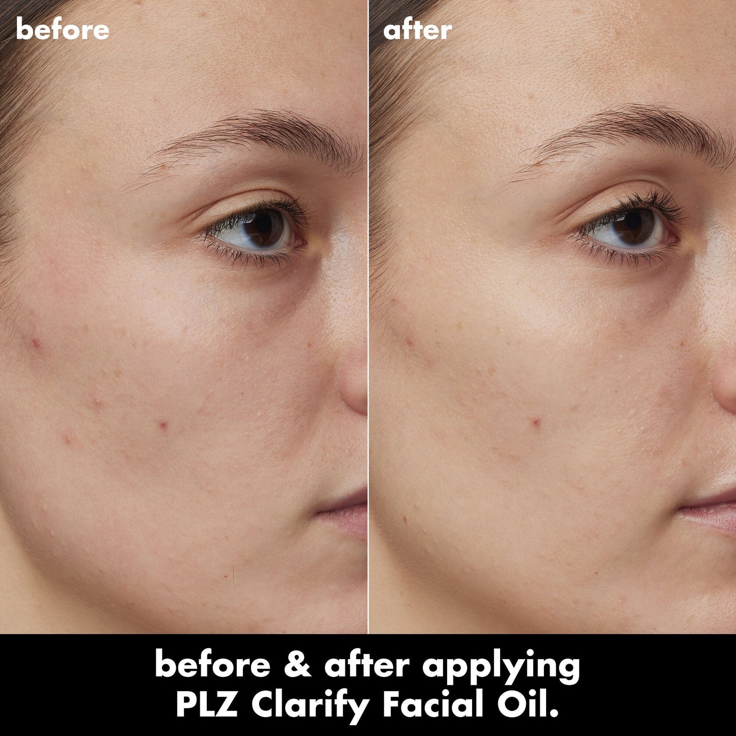 plz-clarify-facial-oil-d3 0326_EDU_PlzClarify_BA_Kelly.jpg
