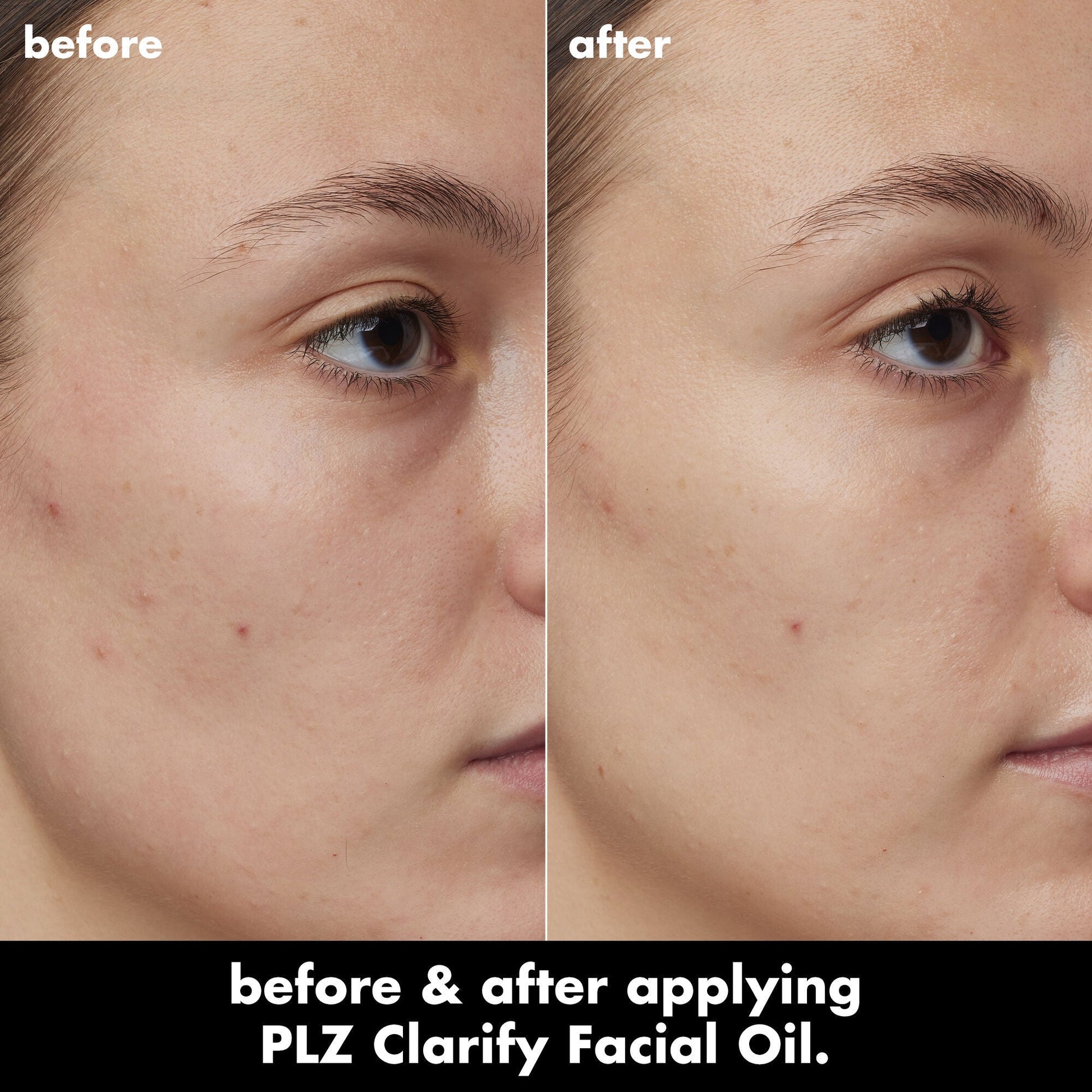 plz-clarify-facial-oil-d3 0326_EDU_PlzClarify_BA_Kelly.jpg
