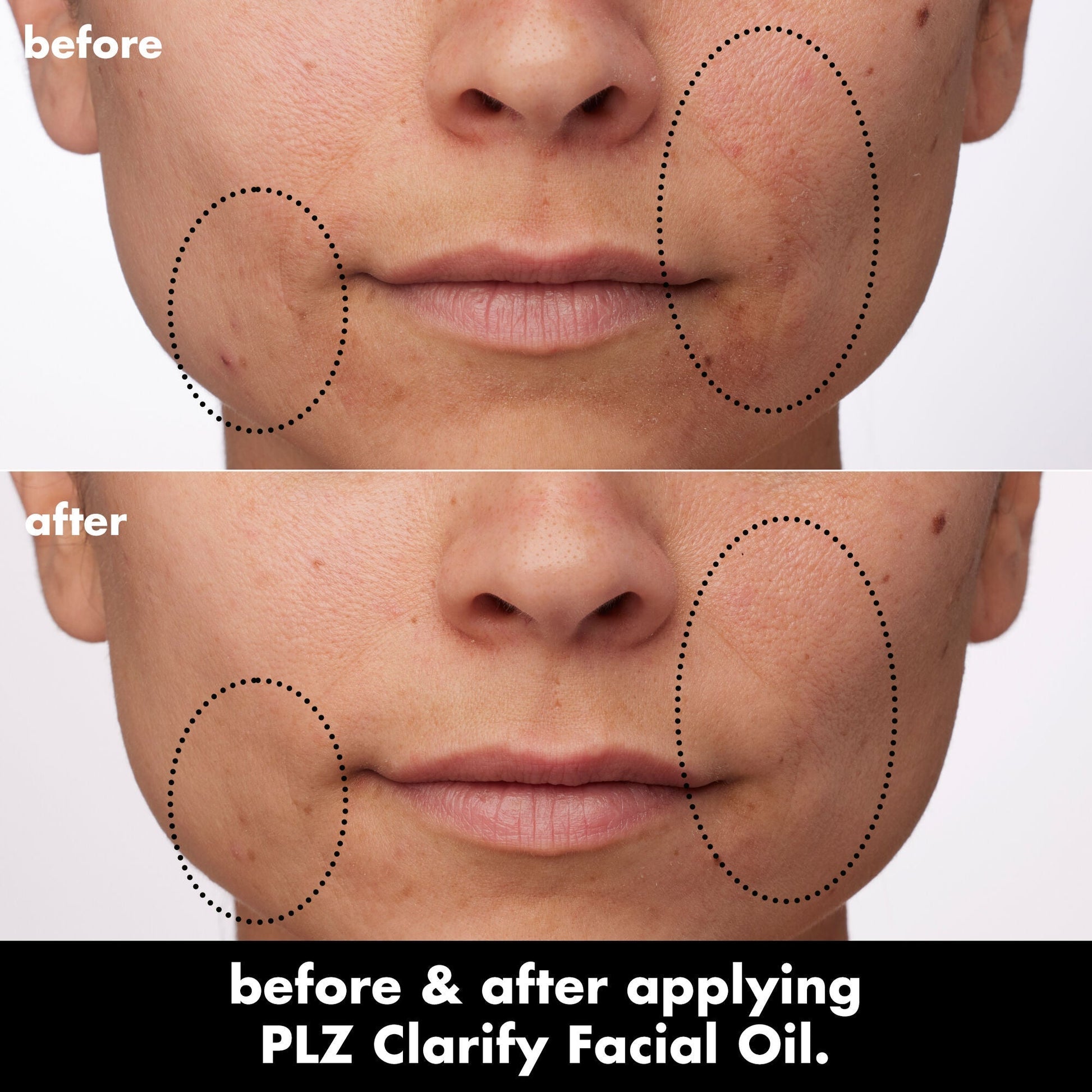 plz-clarify-facial-oil-d3 0326_EDU_PlzClarify_BA_Paula.jpg