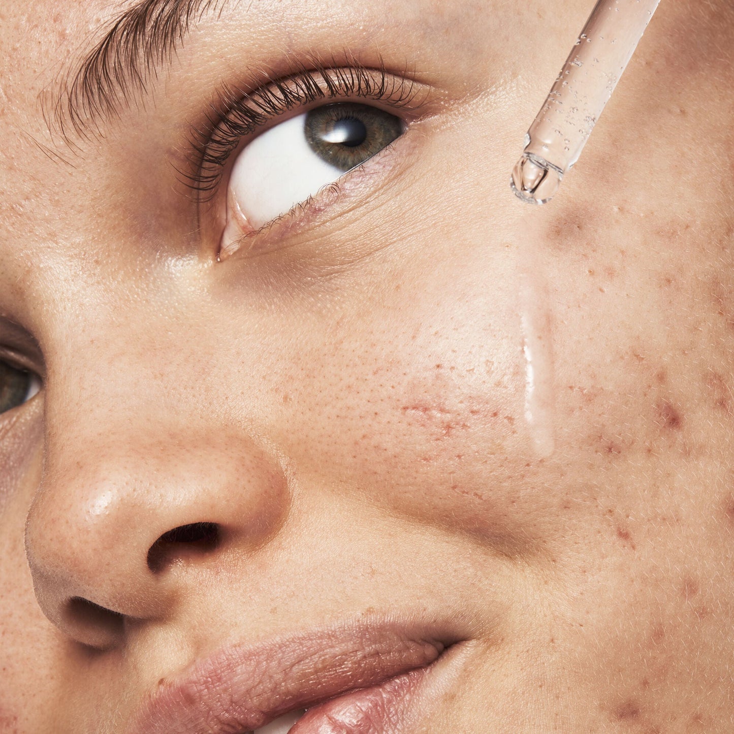 blemish-breakthrough-triple-acid-resurfacing-serum-g9 121321_Marley-Acne-Regimen_0254_FINAL_IGF.jpg