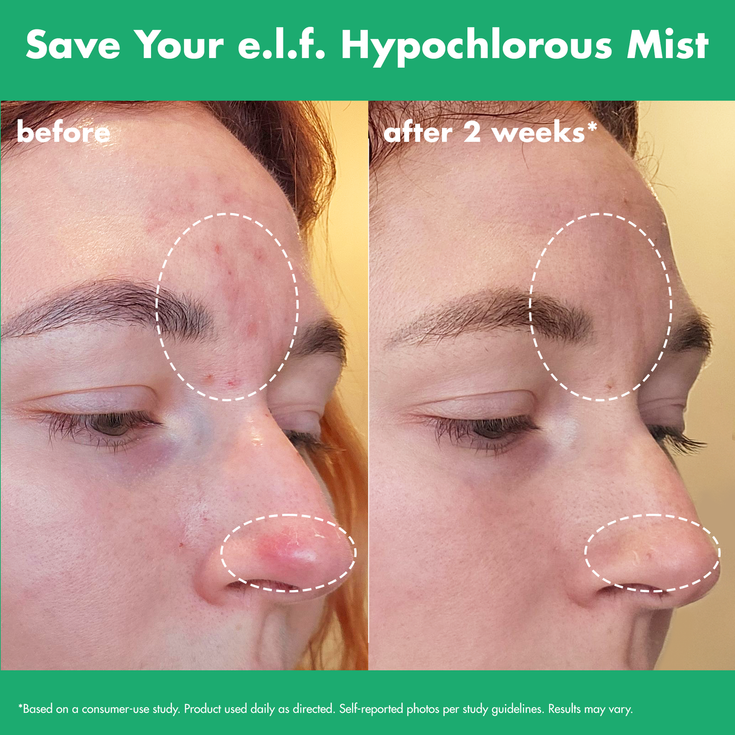 save-your-e-l-f-hypochlorous-mist-n7 FA26_EDUCATION_SAVEYOURELF_USAGE_BA1_WITHOUT_CLAIMS.png