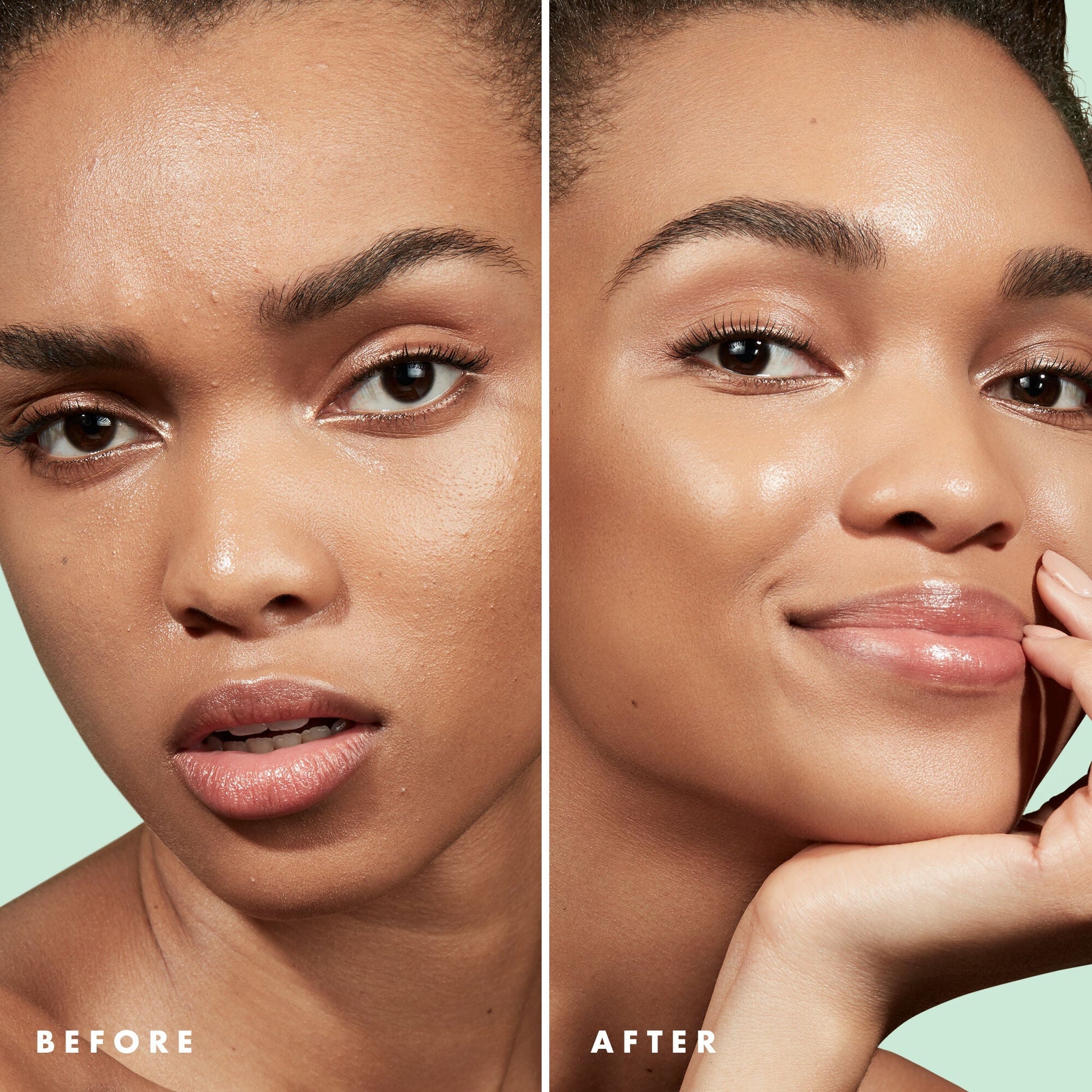 blemish-control-face-primer-large-size-m6 Primer_PP_Before_After_BlemishControl_2000x2000_3774231e-d4e1-49dd-b3d7-a73cbac901fe.jpg
